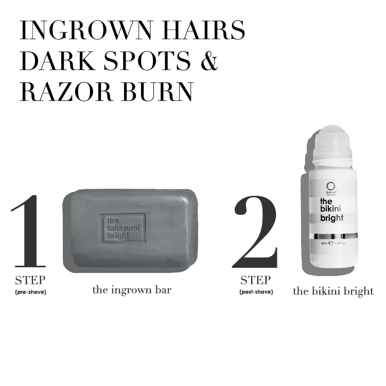 The ingrown bar