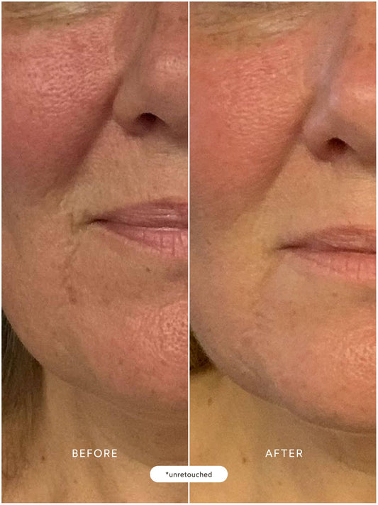 Renew Repair Nightly Treatment (formerly Repair Serum)