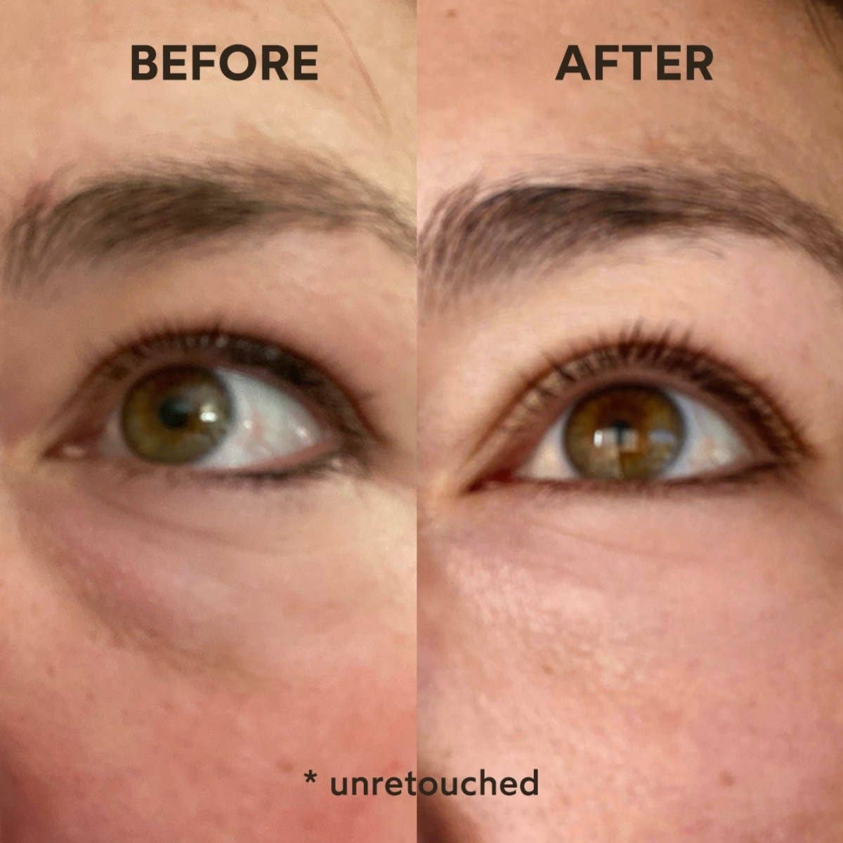 Renew Resurrection Radiance Eye Cream