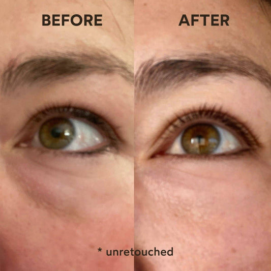 Renew Resurrection Radiance Eye Cream