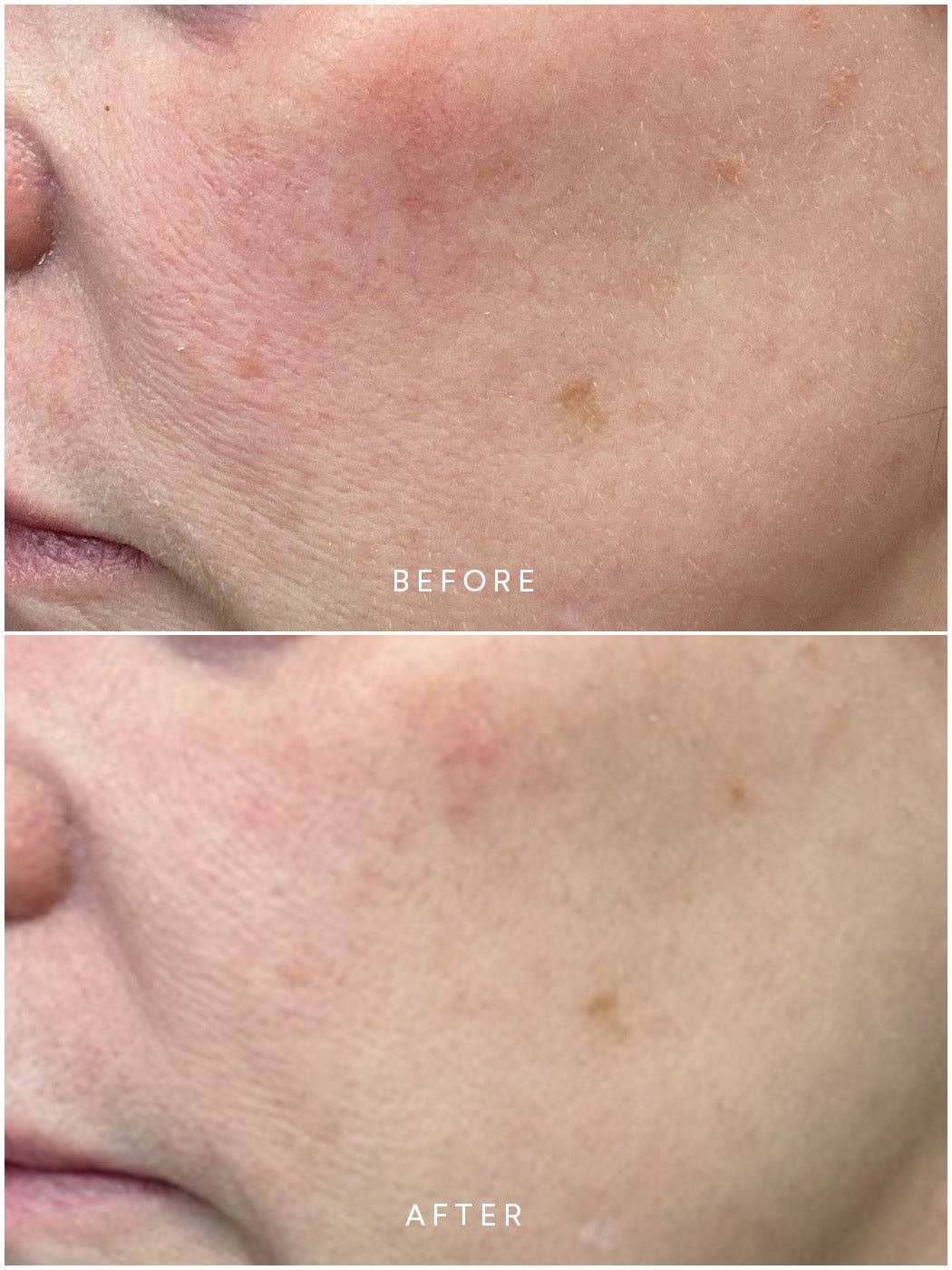 Renew Microbiome Enzyme Essence