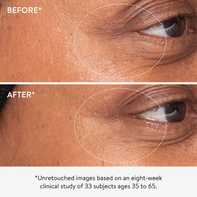 3x Retinol Eye LIft Serum
