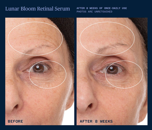 Lunar Bloom Retinal Serum