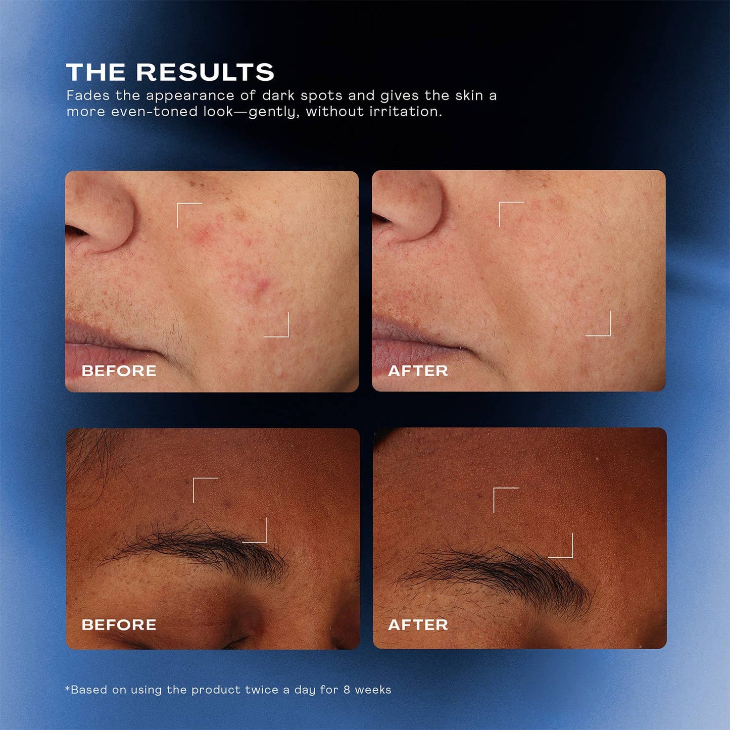Total Clarity Dark Spot Serum