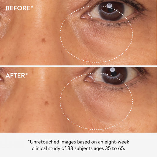 3x Retinol Eye LIft Serum