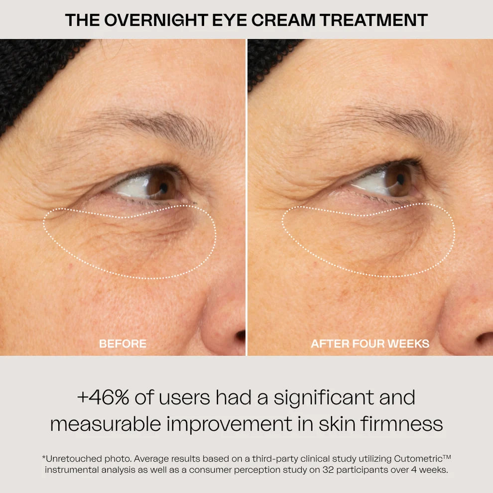 Overnight Eye Cream Treatment